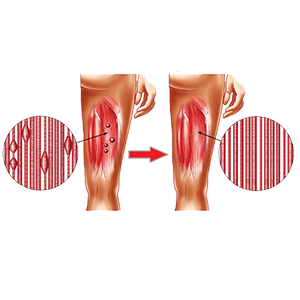 TRIGGER POINTS RELEASE