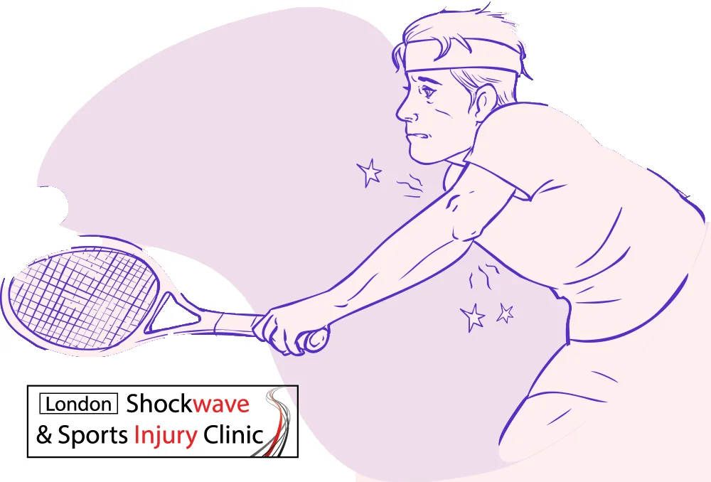 how doesn tennis elbow feel and do i have it - shock wave therapy wimbledon